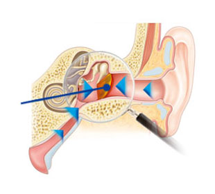 a fül felépítésének anatómiai ábrája